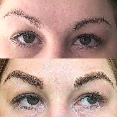 Better symmetry, fullness and a more defined shape was achieved using  microblading.