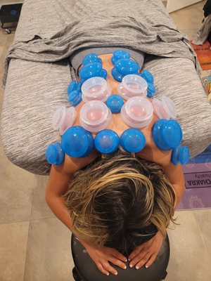 Cupping Therapy