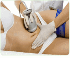 Radiofrequency Cavitation Body Sculpting