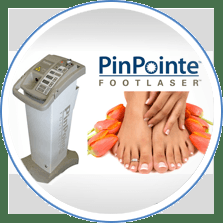 PinPointe Foot Laser for fungus toenails and curing warts.