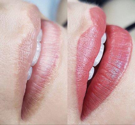 Lips before/after