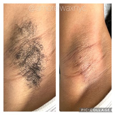 Before & After 
Underarm Wax $15