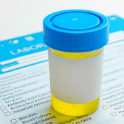 Mobile drug testing services, urine specimen