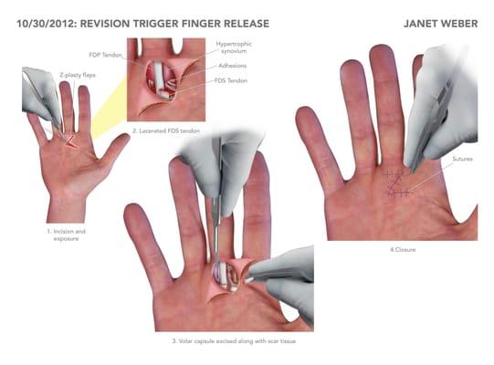 This illustration added $15,000 value to an animal bite that resolved for $60,000.