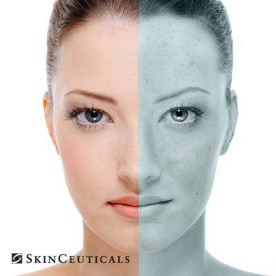 SkinCeuticals Products and Peels