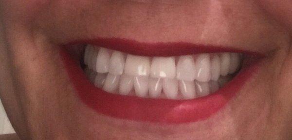 Gleaming pearly whites!!