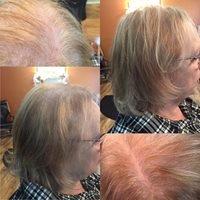 Color Correction and non surgical hair replacement