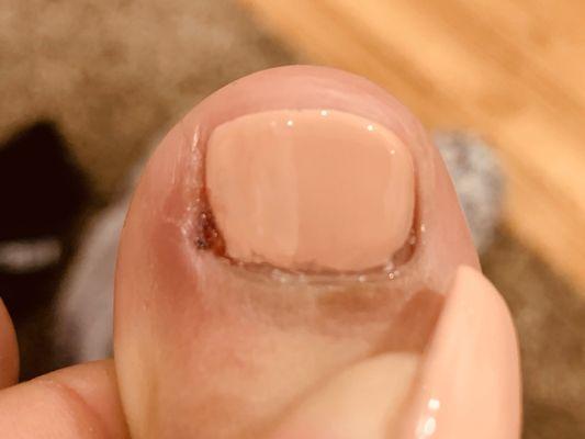 This is my toe ! After the pedicure