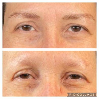 Photo taken 2 hours apart.Before and after eye brow PMU. Work done by Yolanda Alvarez at Artistic Ink in Santa Rosa.