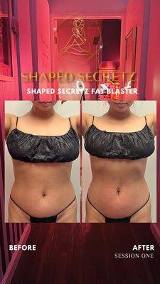 Body Sculpting Treatment - Before and After