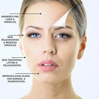 Have you ever considered Micro-needling?  We offer that service @ The Clinic.