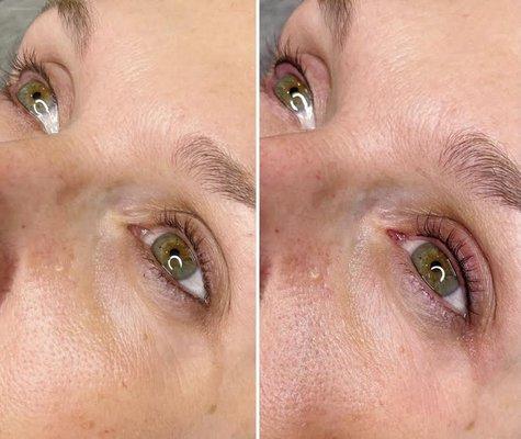 Lash line enhancement