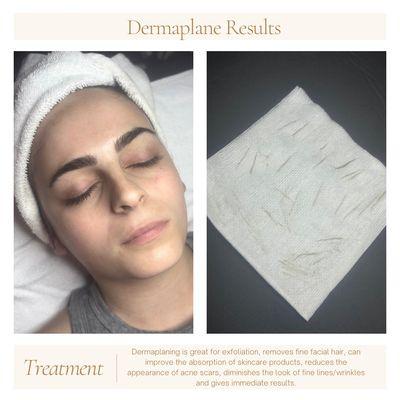 Dermaplane Service