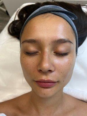 Facial