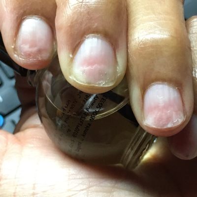 My nails still recovering 3 weeks after excessive buffing to remove gel polish by tech at Luxury in Mount Airy.