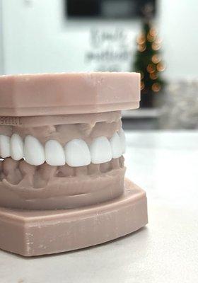 Wax-ups are made to create an ideal version of your teeth and to help you visualize the final outcome