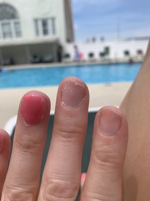 Even my bare nails were a wreck