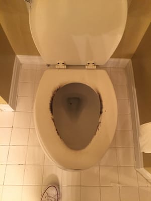 Toilet seats are a health hazard...you have to TRY REALLY HARD to get them to this point, this is disgusting!