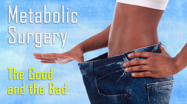 gastric sleeve surgeries, weight loss