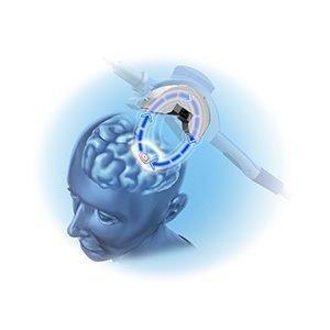 TMS procedure simulation