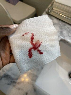 This was my second napkin from trying to clean up the blood off my eye.