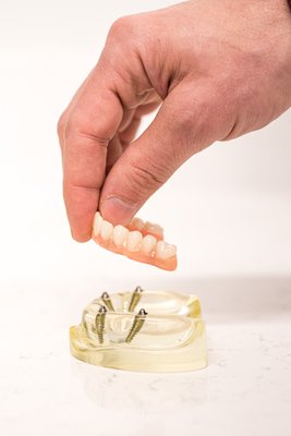 All-on-4 dental implants model