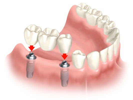 Johns Creek Family and Cosmetic Dentistry