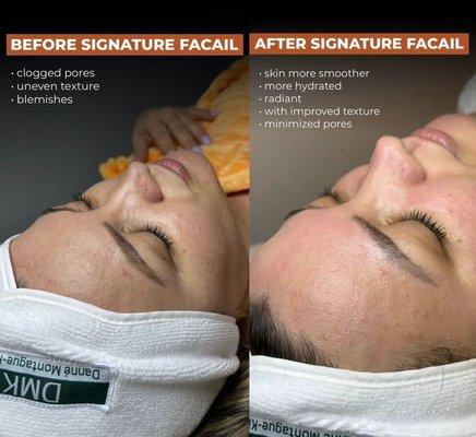 Signature Facial is a treatment service for you skin to make it looks younger and stunning‍