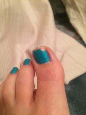 My toes chipped after a week!