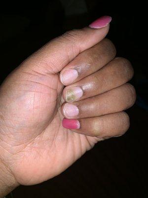 Not even 2 weeks later and the nails came off...and what's that green on my nail you ask? Fungus