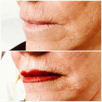 Permanent Lip Makeup