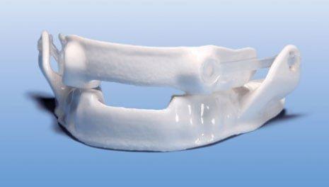 3D Printed nylon oral appliance for sleep apnea and snoring. Flexible, lightweight, and ultrathin.