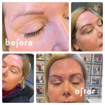 Microblading to make proper shape