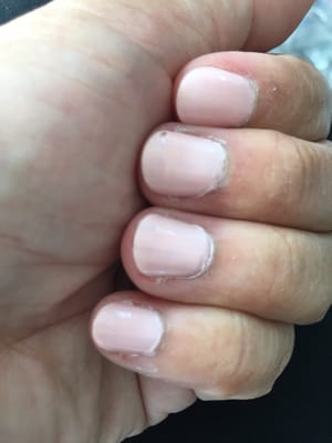 Uneven nail polish, cuticles not clean