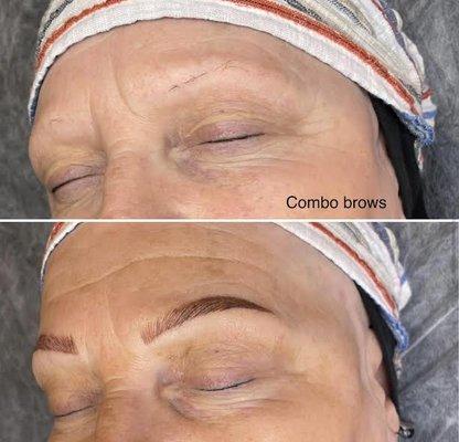 Combo brows for a client with alopecia