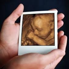 3D 4D Ultrasonography