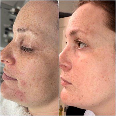 Jackie C skin therapy