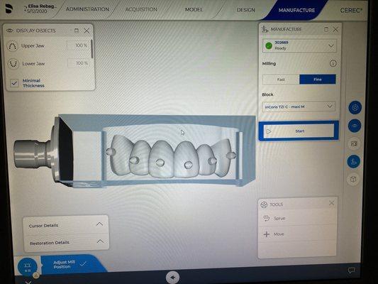 In-house dental lab with computer aided design and manufacturing for optimal aesthetics and single visit dentistry.