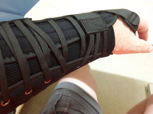 New splint