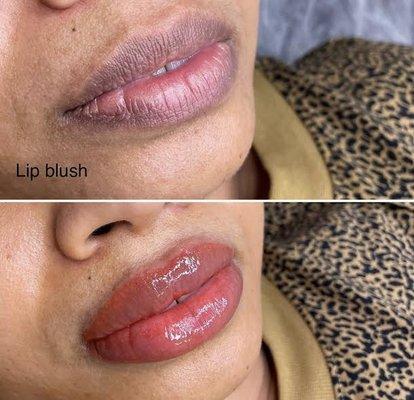 Lip Blush for hyperpigmentation