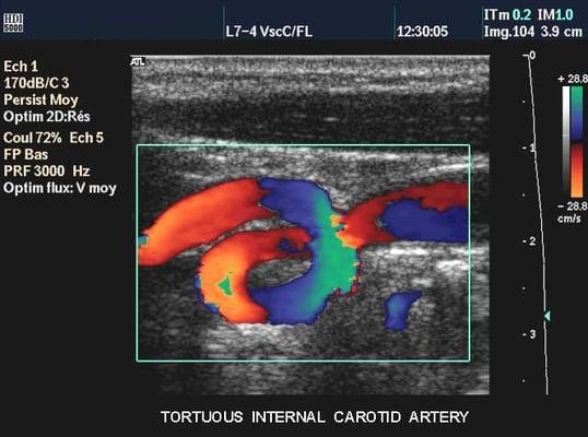 Mobile Ultrasound Services