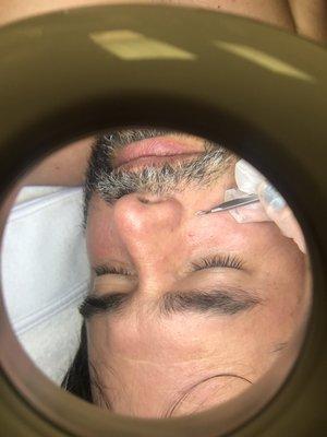 Silk facial with microdermabrasion.