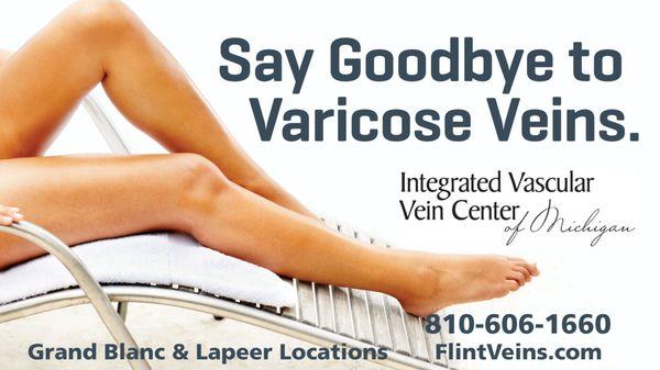 Say goodbye to varicose veins.