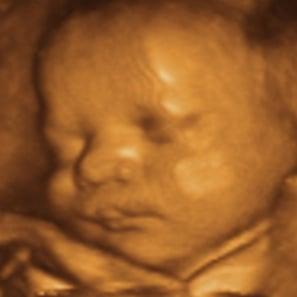 Cloud Nine 3D/4D Ultrasound