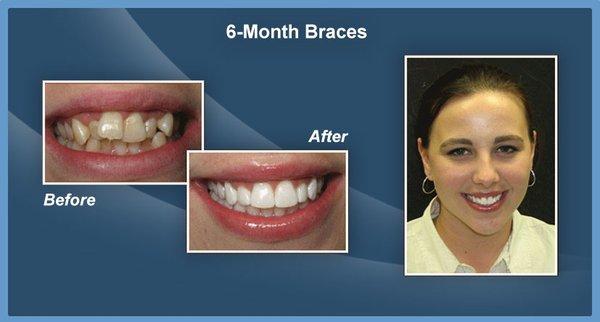 Smiles Makeover Dentist Spring TX 77379, Cosmetic Dentistry