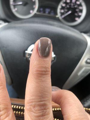 SNS side of nail missed