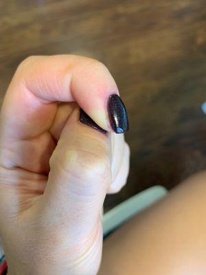 Dull, uneven mark on nail