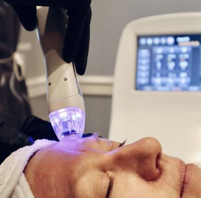 Microneedling with radio frequency for acne scars, pigmentation, texture, and tone. Also rebuilds collagen and elastin.