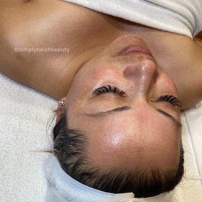 Simply Eurolax Facial with Microdermabrasion