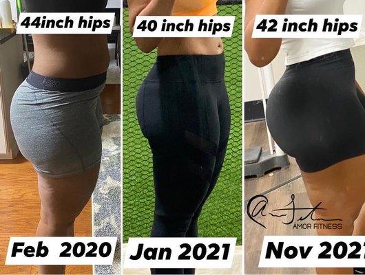 Glute reshaping and lift